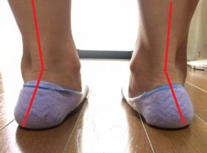 腰痛で整体やマッサージに通う方へ 靴も見直して施術効果をアップ 和歌山 メディカルフットケア アン