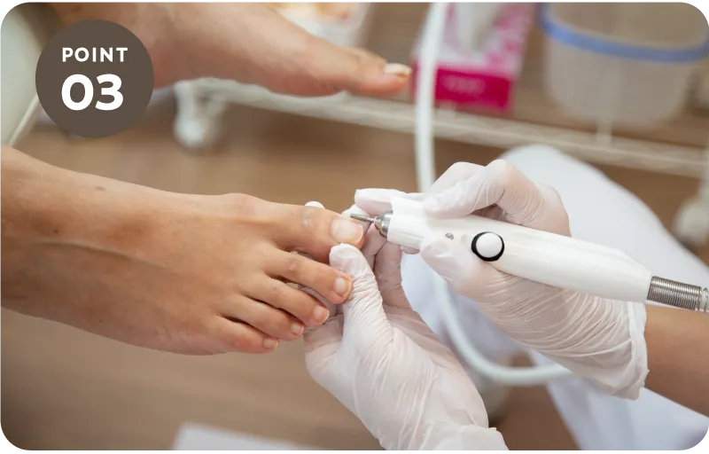 メディカルフットケアアン セラピスト畠の巻き爪施術風景